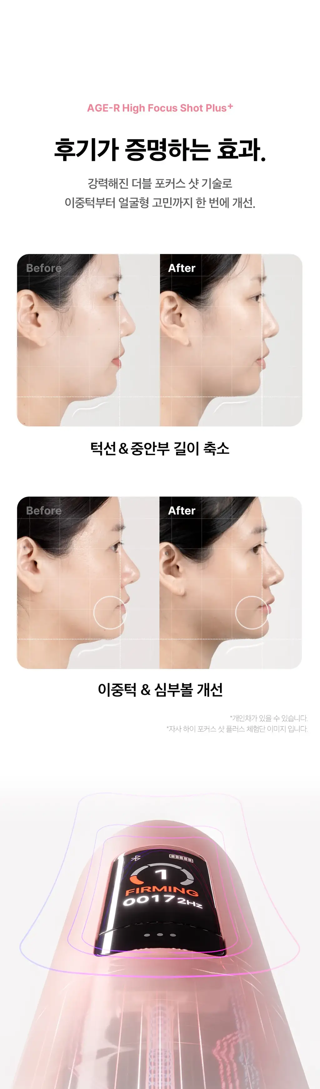 [디바이스 2관왕] 메디큐브 부스터프로 짱구 에디션/미니플러스/브이롤러 기획/하이포커스샷 플러스 택 1 상세페이지 212